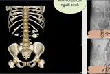Xem phim chụp CT, bác sĩ “tá hỏa” khi thấy điều không ai ngờ trong thận người bệnh