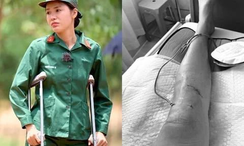Siêu mẫu Minh Tú chấn thương nghiêm trọng, bác sĩ lên tiếng cảnh báo