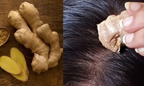 Cách gội đầu bằng nước gừng giúp giảm rụng tóc
