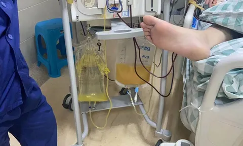 Chàng trai 19 tuổi máu đục như sữa, suy đa tạng nguy kịch vì 2 kiểu LƯỜI người trẻ thường mắc phải
