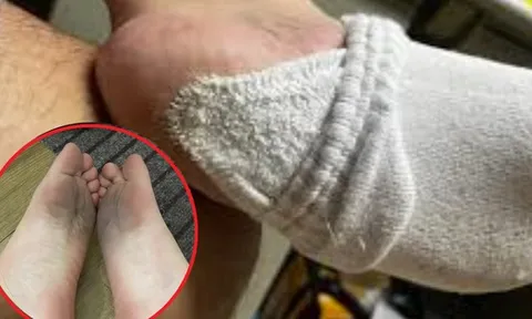 4 loại “tất độc” bị điểm tên, đừng ham rẻ mà rước bệnh vào người