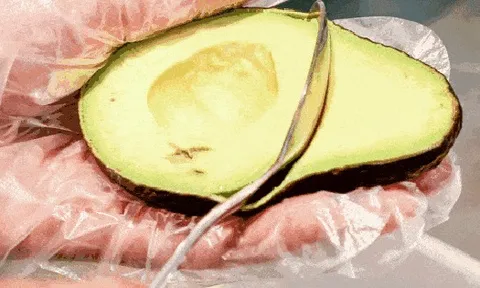5 thực phẩm "siêu béo" nhưng giúp đốt mỡ