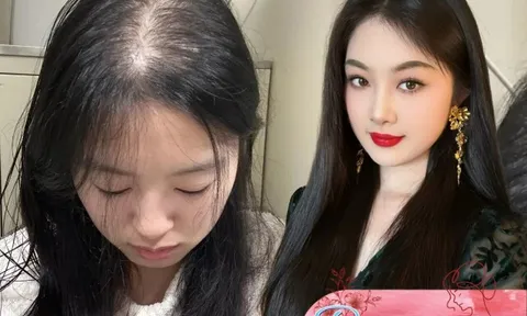 Tóc mọc chậm mãi không dài lại hay rụng nhiều, thử ngay bí quyết giúp tóc dài gấp đôi trong 1 tháng của gái Hàn