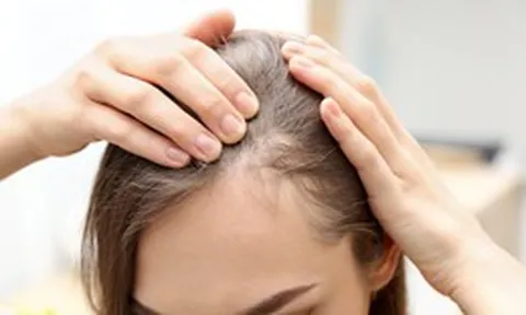 Bất ngờ, 2 loại đồ uống giúp ngăn ngừa rụng tóc vào mùa thu