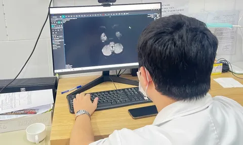 Tổn thương não, suy thận do hút thuốc lá điện tử chứa ma túy tổng hợp 0