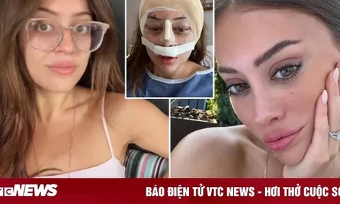 Sợ già đến ám ảnh, các cô gái tuổi 20 đua nhau làm phẫu thuật dành cho U60