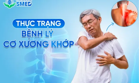 SMED – Hệ thống chăm sóc sức khỏe tiên phong trong điều trị cơ xương khớp 0