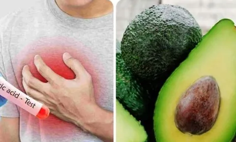 Cách ăn uống để giảm axit uric hiệu quả nhất