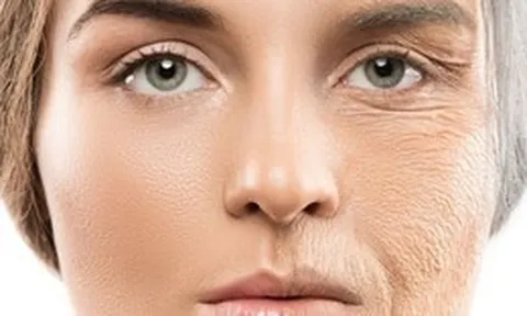 Kem chống nắng - tấm lá chắn chống lão hóa mùa hanh khô