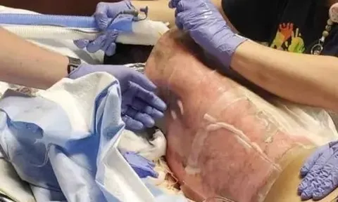 5 thử thách TikTok cực nguy hiểm, có một thử thách từng giết chết hơn 100 người