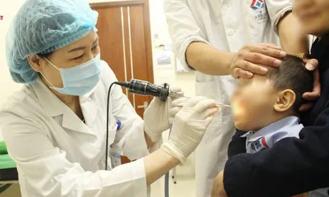 Phân biệt cúm A và viêm amidan 0