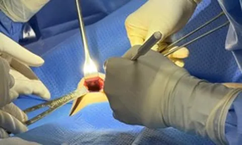 Tháo túi ngực và thay túi ngực: Phương pháp gây mê, kỹ thuật phẫu tích, hồi phục