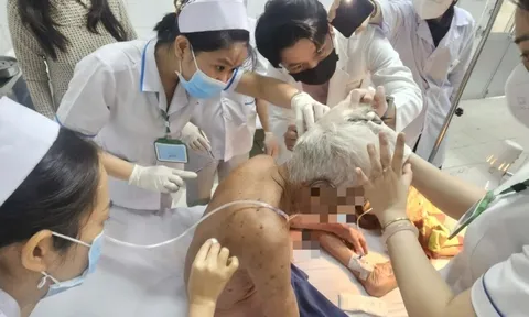 Cụ ông 74 tuổi ở Đồng Tháp bị ong đốt hơn 100 mũi đã tử vong