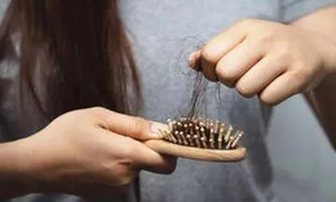 Điều ít ai để ý: Sức khỏe đường ruột kém gây rụng tóc