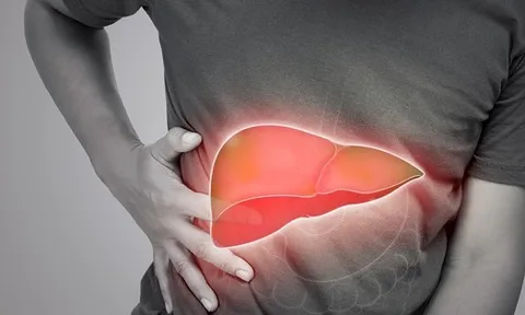 Mắc bệnh gan nhiễm mỡ vì thứ tưởng rằng "lành mạnh"