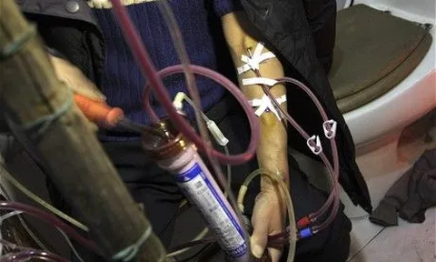 Nam kỹ sư 26 tuổi đột ngột phát hiện suy thận giai đoạn 4 kể: "Tôi chỉ đi khám đau ngón chân thôi mà!"