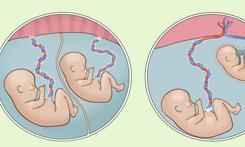 Bé trai nặng chưa đầy 1 kg được cứu sống thần kỳ