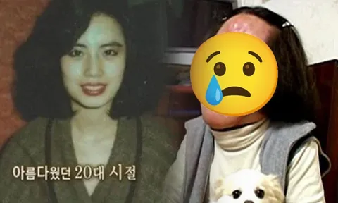 "Thảm họa thẩm mỹ" cuồng loạn tự tiêm dầu ăn vào mặt, từ mỹ nhân xinh đẹp cuối đời ra đi trong đau đớn