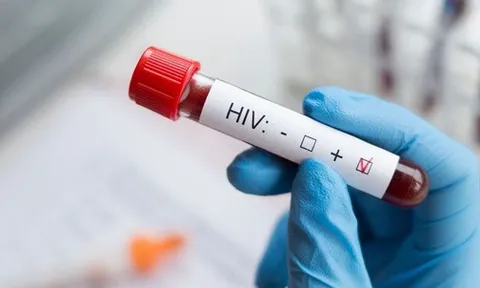 Đi khám sức khỏe định kỳ, nam shipper 35 tuổi phát hiện nhiễm HIV: Choáng váng khi biết nguồn lây