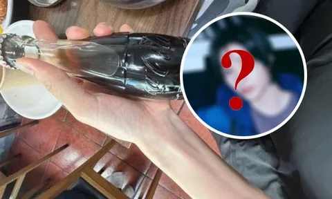 Nam ca sĩ lộ cánh tay chỉ còn "da bọc xương", fan phát hoảng