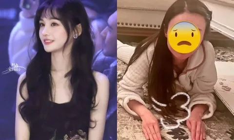 Gương mặt ngày càng biến dạng đến đáng sợ của Trịnh Sảng