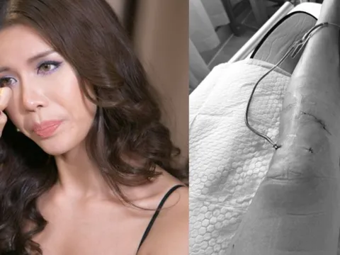 Siêu mẫu Minh Tú sốc vì bị đứt dây chằng chéo trước, rách sụn, dập xương
