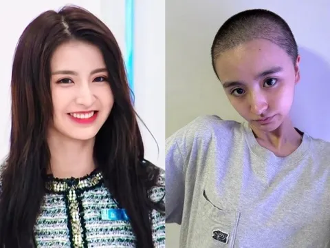Nữ ca sĩ cạo trọc đầu gây lo lắng