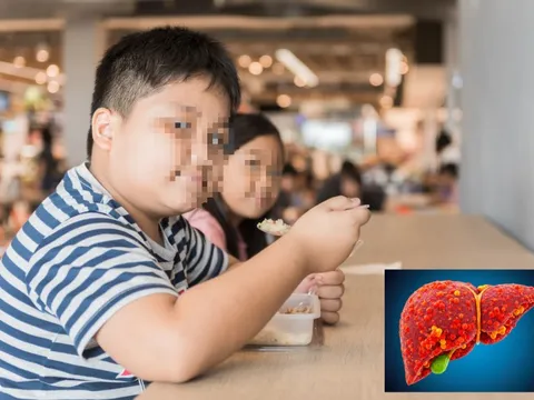 Mới 11-12 tuổi đã mắc mỡ máu, gan nhiễm mỡ, đường huyết 'cao vút': Bác sĩ chỉ đích danh ‘thủ phạm’