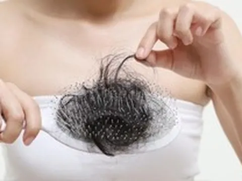Tóc rụng nhiều khi tắm gội có bất thường?