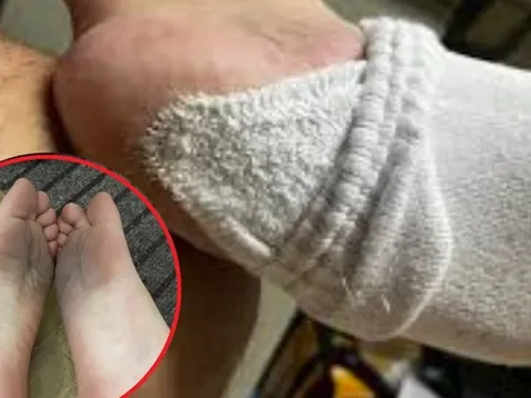 4 loại “tất độc” bị điểm tên, đừng ham rẻ mà rước bệnh vào người