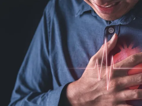 Phát hiện thêm nguyên nhân gây nhồi máu cơ tim
