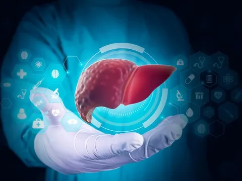 Ba điều nguy hiểm nhất đối với người bị gan nhiễm mỡ