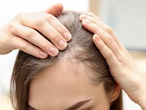 Bất ngờ, 2 loại đồ uống giúp ngăn ngừa rụng tóc vào mùa thu