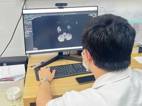 Tổn thương não, suy thận do hút thuốc lá điện tử chứa ma túy tổng hợp 0