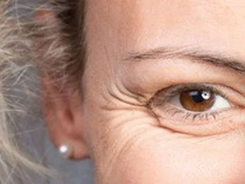4 giải pháp làm chậm lão hoá, giúp trẻ lâu ai cũng có thể thực hiện