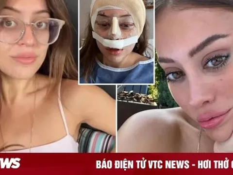 Sợ già đến ám ảnh, các cô gái tuổi 20 đua nhau làm phẫu thuật dành cho U60