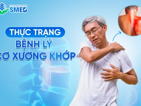 SMED – Hệ thống chăm sóc sức khỏe tiên phong trong điều trị cơ xương khớp 0