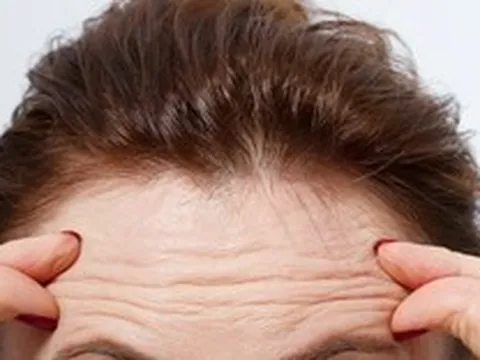 Thực phẩm bổ sung nào giúp chống lại nếp nhăn?