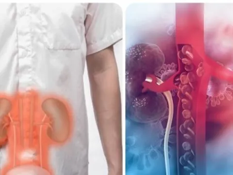 Suy thận có dấu hiệu gì?