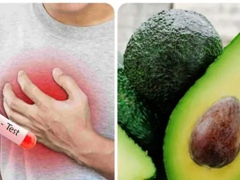 Cách ăn uống để giảm axit uric hiệu quả nhất