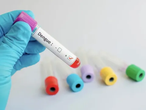 Viện Pasteur TP HCM thử nghiệm vắc-xin sốt xuất huyết trên 4.000 người Việt