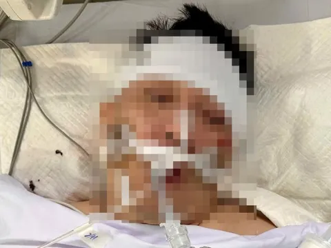 Tìm thân nhân người đàn ông bị tai nạn giao thông nặng đang cấp cứu trong bệnh viện