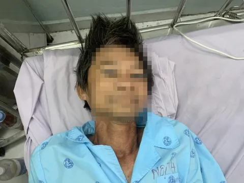 Tìm thân nhân người đàn ông bất tỉnh ngoài đường ở phường Tam Bình, TP HCM