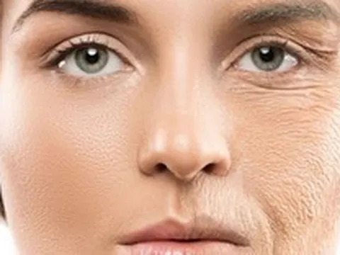 Kem chống nắng - tấm lá chắn chống lão hóa mùa hanh khô