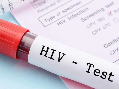 Bị chồng ruồng bỏ năm 24 tuổi, 4 năm sau nhận tin nhiễm HIV: Nguyên nhân đến từ sự lầm lỡ