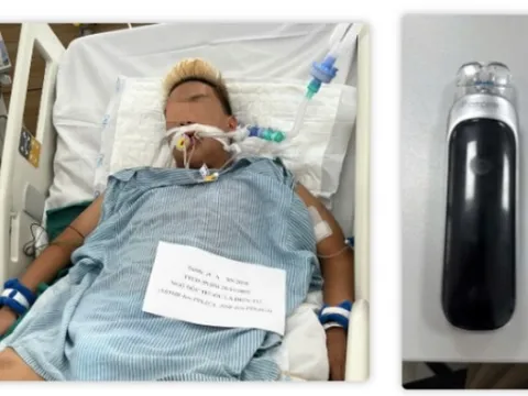 Suy thận, phổi tắc nghẽn vì hút thuốc lá điện tử từ năm 13 tuổi 0