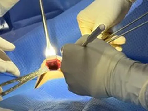 Tháo túi ngực và thay túi ngực: Phương pháp gây mê, kỹ thuật phẫu tích, hồi phục