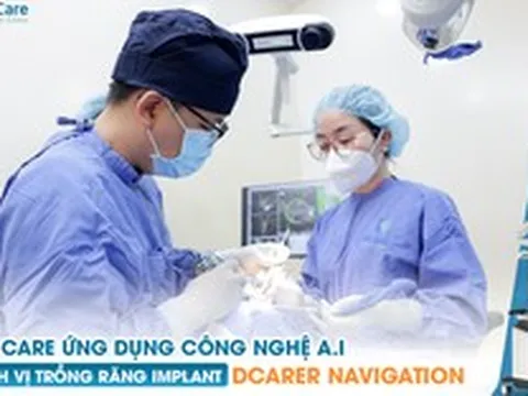 Trồng răng số 5 giá bao nhiêu - lựa chọn trồng răng Implant sao cho đúng?
