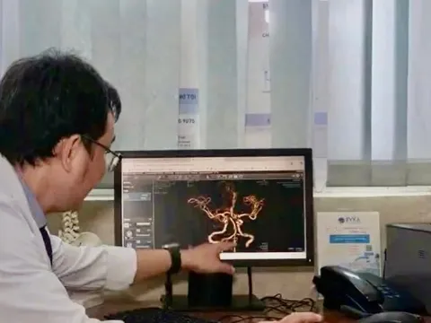 Đột quỵ khi thức giấc, dấu hiệu cảnh báo tuyệt đối không được bỏ qua