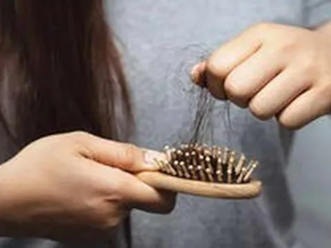 Điều ít ai để ý: Sức khỏe đường ruột kém gây rụng tóc